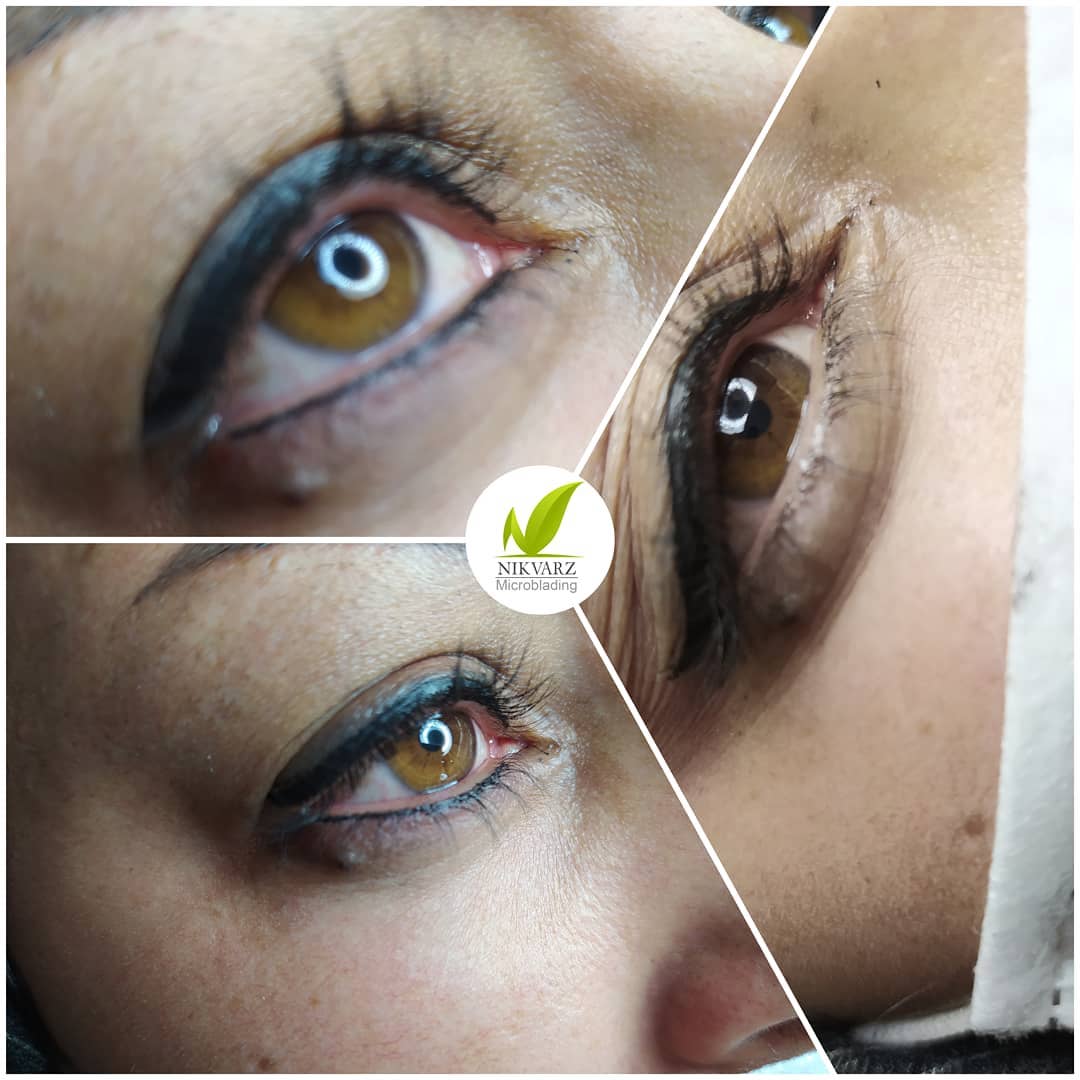 بن مژه پایین چشم