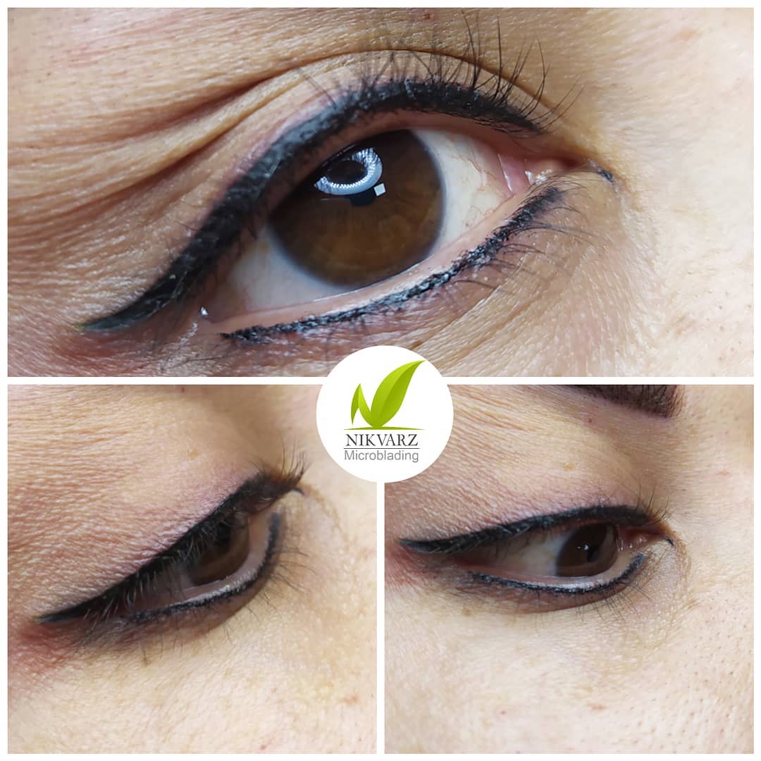 تکنیک خط چشم بالا و پایین